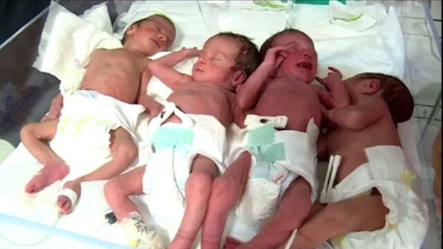 تولد نوزادان چهارقلو در گچساران