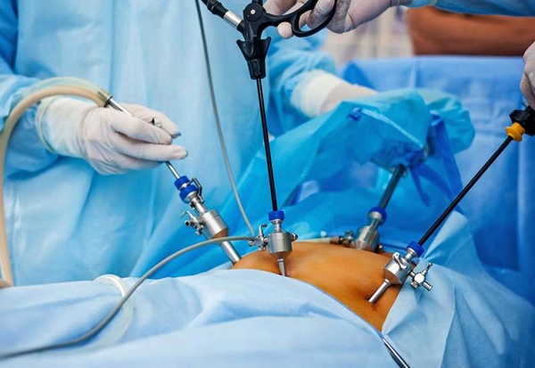 جراحی سرطان معده به روش نوین در بیمارستان شهید جلیل یاسوج انجام شد