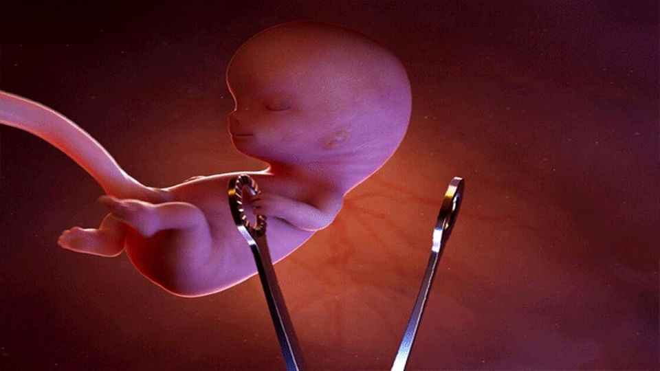 وزارت بهداشت: برخورد با سقط عمدی جنین در دستور کار قرار دارد